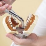 抜歯を避ける神経治療と定期検診の重要性
