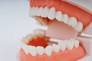 骨粗鬆症と口腔内の関係